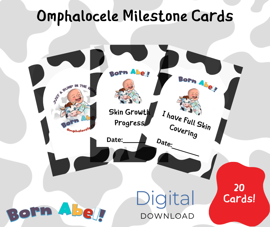 Omphalocele Milestone Cards - Digital Download